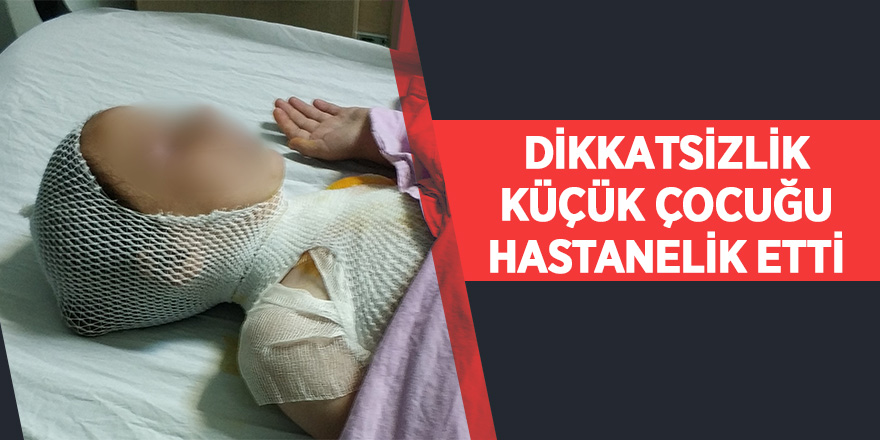 Kaynatılırken taşan süt çocuğu hastanelik etti 