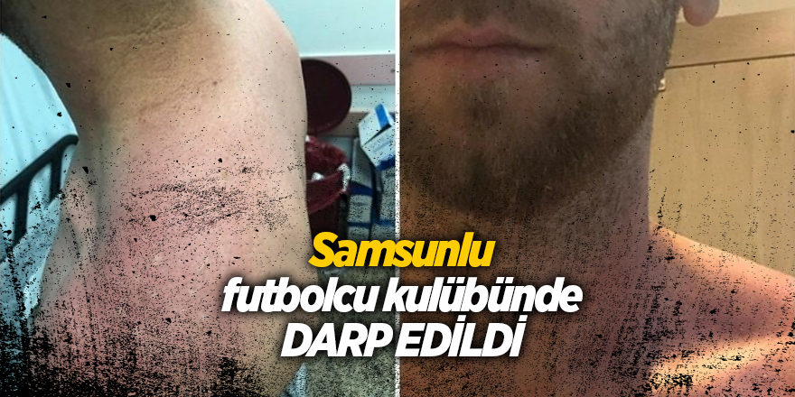 Samsunlu futbolcuyu kulüp başkanı korumasına dövdürdü