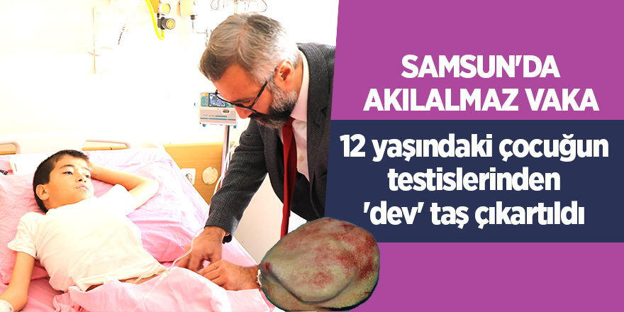 12 yaşındaki çocuğun testislerinden 'dev' taş çıkartıldı