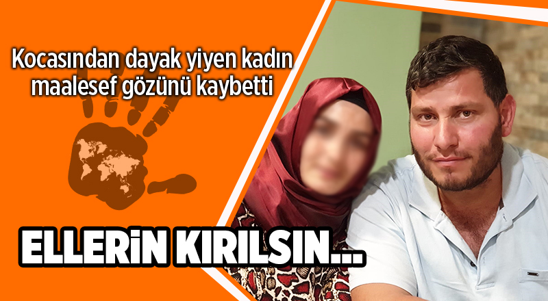 Samsun'da koca dehşeti