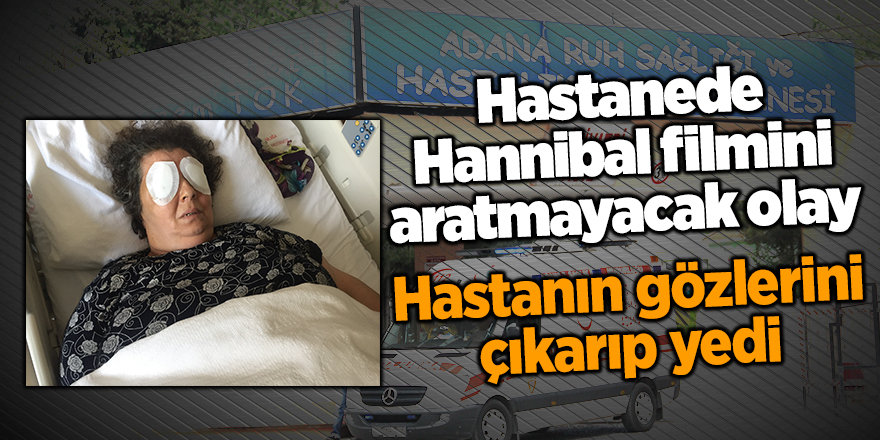 Hastanede Hannibal filmini aratmayacak olay