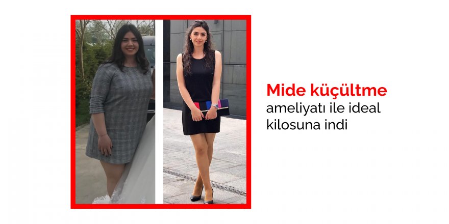 Samsun Büyük Anadolu Hastaneleri'nde Mide küçültme ameliyatı ile ideal kilosuna indi