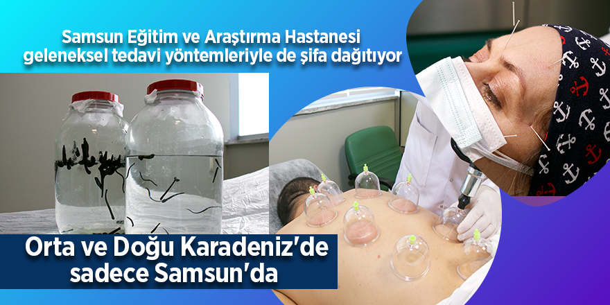 Samsun Eğitim ve Araştırma Hastanesi  geleneksel tedavi yöntemleriyle de şifa dağıtıyor