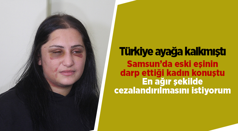 Samsun’da eski eşinin darp ettiği kadın konuştu - samsun haber