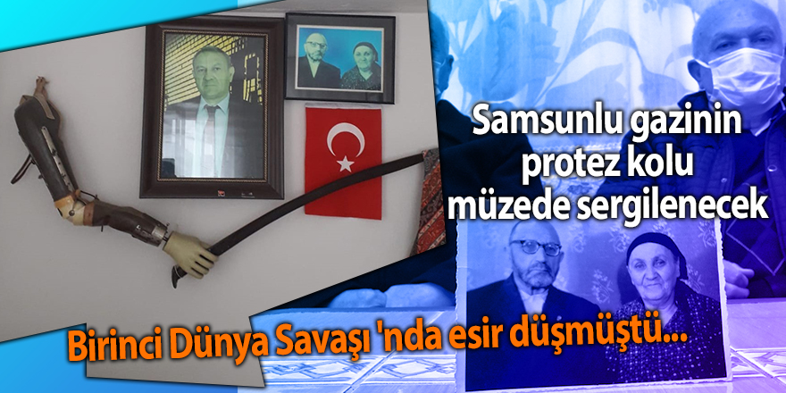 Samsunlu gazinin protez kolu  müzede sergilenecek - samsun haber