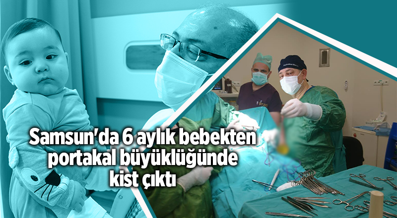 Samsun'da 6 aylık bebekten portakal büyüklüğünde kist çıktı - samsun haber