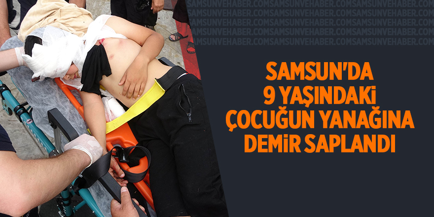 Samsun'da 9 yaşındaki çocuğun yanağına demir saplandı - samsun haber