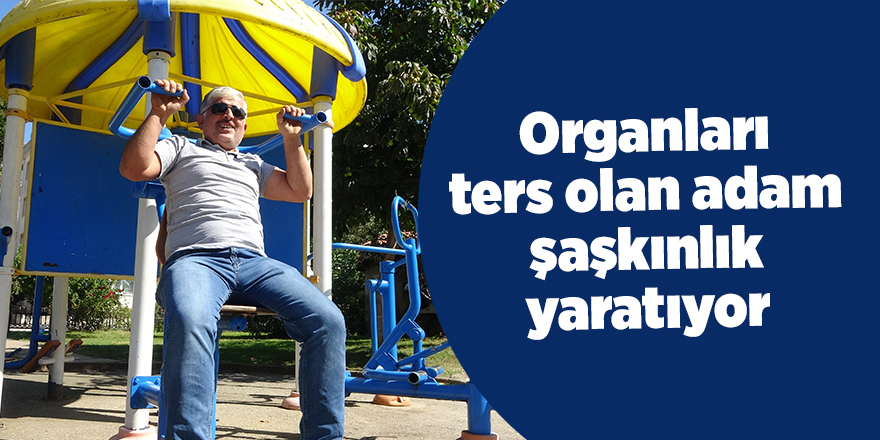 Organları ters olan adam şaşkınlık yaratıyor