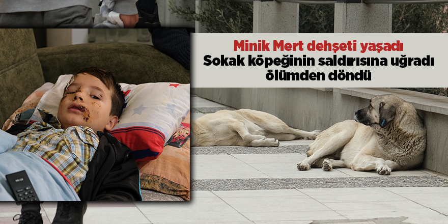 Minik Mert dehşeti yaşadı! Sokak köpeğinin saldırısına uğradı ölümden döndü