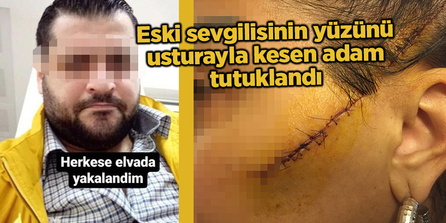 Eski sevgilisinin yüzünü usturayla kesen adam tutuklandı