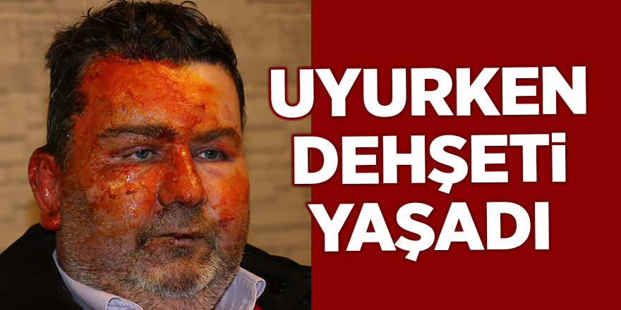 Uyurken dehşeti yaşadı