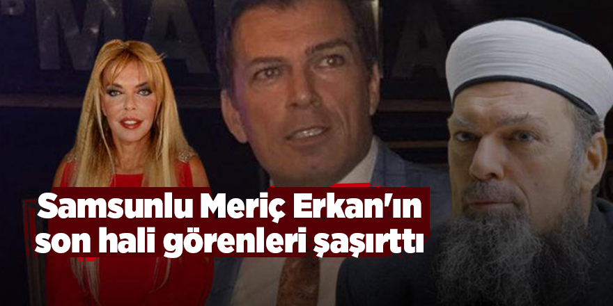 Samsunlu Meriç Erkan'ın son hali görenleri şaşırttı