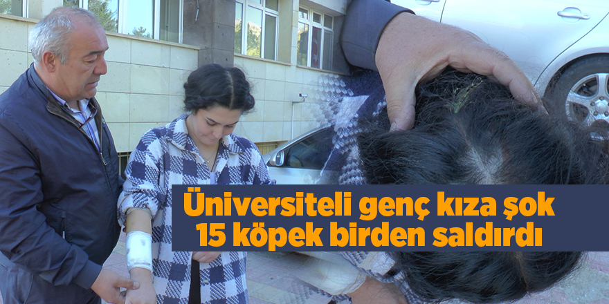 Üniversiteli genç kıza şok 15 köpek birden saldırdı