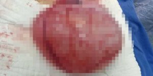 Kist korkulu rüyanız olmasın