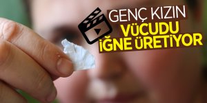 Genç kızın vücudu iğne üretiyor 