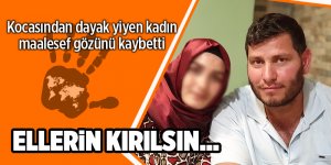 Samsun'da koca dehşeti