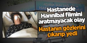 Hastanede Hannibal filmini aratmayacak olay