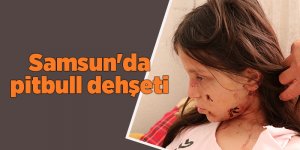 Pitbull saldırısına uğrayan çocuk yaralandı - samsun haber