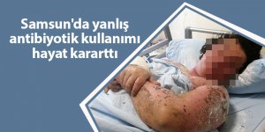 Samsunlu Çilem'in bitmeyen çilesi - samsun haber