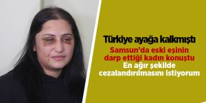 Samsun’da eski eşinin darp ettiği kadın konuştu - samsun haber