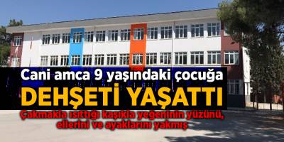 Cani amca 9 yaşındaki çocuğa dehşeti yaşattı