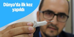 İmplant dünyasında çığır açacak gelişme: Dünyada ilk kez yapıldı